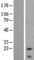 LY6G6C Human Over-expression Lysate