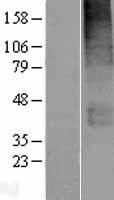SLC19A3 Human Over-expression Lysate