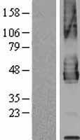PD L2 (PDCD1LG2) Human Over-expression Lysate