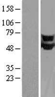 CPEB1 Human Over-expression Lysate