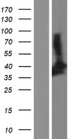 SIRT2 Human Over-expression Lysate