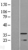 TMEM177 Human Over-expression Lysate