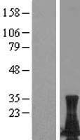 LIMD2 Human Over-expression Lysate