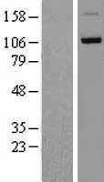 DDHD1 Human Over-expression Lysate