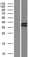 Ataxin 3 (ATXN3) Human Over-expression Lysate