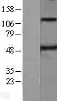 TMPRSS5 Human Over-expression Lysate