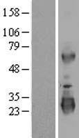 LRRC3 Human Over-expression Lysate