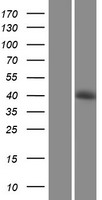 SHARPIN Human Over-expression Lysate