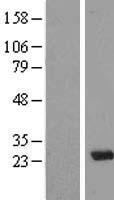 MAD3 (MXD3) Human Over-expression Lysate