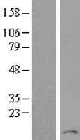 Transmembrane protein 93 (EMC6) Human Over-expression Lysate
