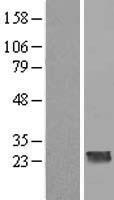 CCDC70 Human Over-expression Lysate