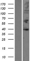 HNRNPD Human Over-expression Lysate