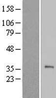 TEX101 Human Over-expression Lysate
