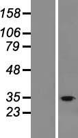 TLCD3B Human Over-expression Lysate