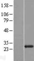FGFBP2 Human Over-expression Lysate