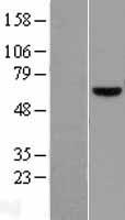 PATZ1 Human Over-expression Lysate