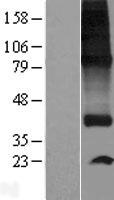 SPNS1 Human Over-expression Lysate