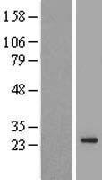 TMEM222 Human Over-expression Lysate
