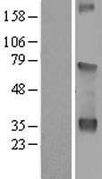 WDR54 Human Over-expression Lysate