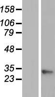GAJ (MND1) Human Over-expression Lysate