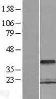 PCGF6 Human Over-expression Lysate