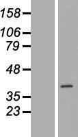 BXDC1 (RPF2) Human Over-expression Lysate