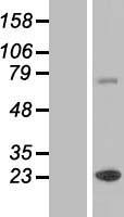 ZCCHC7 Human Over-expression Lysate