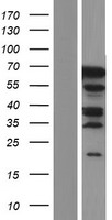 PHF20L1 Human Over-expression Lysate