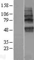 TMEM117 Human Over-expression Lysate