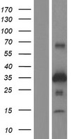 ZNRF1 Human Over-expression Lysate