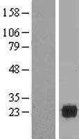 C21ORF56 (SPATC1L) Human Over-expression Lysate