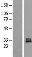 POLR3GL Human Over-expression Lysate