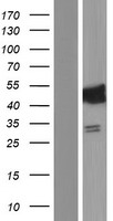 HSDL2 Human Over-expression Lysate