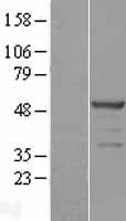 SKAR (POLDIP3) Human Over-expression Lysate