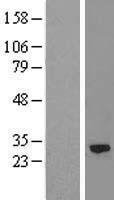 Calpain S2 (CAPNS2) Human Over-expression Lysate