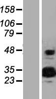 EFCAB2 Human Over-expression Lysate