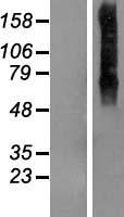 Transmembrane Protein 175 (TMEM175) Human Over-expression Lysate