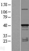 TMEM79 Human Over-expression Lysate