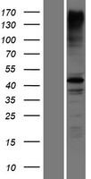 RNF135 Human Over-expression Lysate