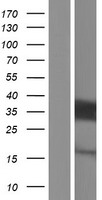 ACBD6 Human Over-expression Lysate