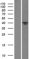 BRMS1L Human Over-expression Lysate