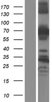 ABLIM2 Human Over-expression Lysate