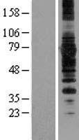 SYVN1 Human Over-expression Lysate