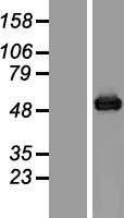 Aspartate beta hydroxylase (ASPH) Human Over-expression Lysate