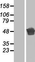 Aspartate beta hydroxylase (ASPH) Human Over-expression Lysate