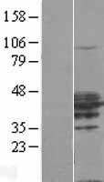 RHOXF2 Human Over-expression Lysate