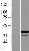 ZC3H8 Human Over-expression Lysate