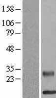 RELM beta (RETNLB) Human Over-expression Lysate