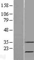 Ribonuclease 7 (RNASE7) Human Over-expression Lysate