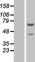 GLYR1 Human Over-expression Lysate